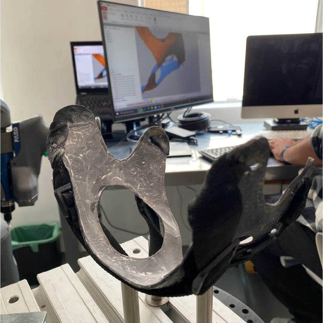 Resin model scan — Building the fit for the digital model